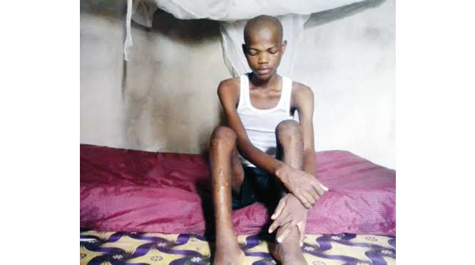 Recuperating SS1 student of Ishieke Secondary School, Ebonyi Local Government Area of Ebonyi State has revealed why he embarked on a 41-day dry fasting which landed him in the hospital after concluding it, but died after a week in the hospital